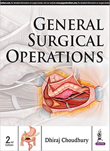 General Surgical Operations 2nd Edition